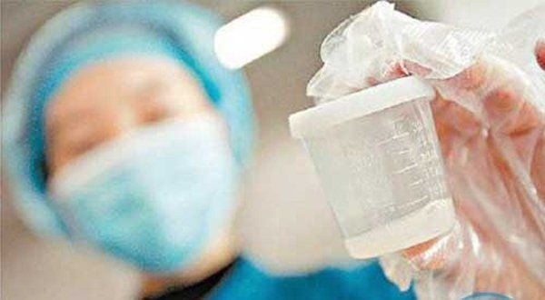 Kinh doanh dịch vụ lưu trữ tinh trùng
