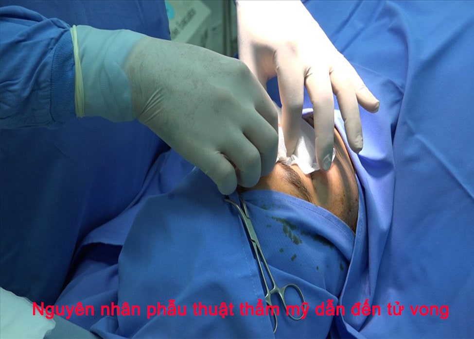 Cần làm gì để ngăn chặn phẫu thuật thẩm mỹ dẫn đến tử vong?