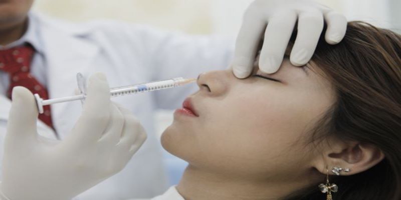 Nâng mũi bị biến chứng